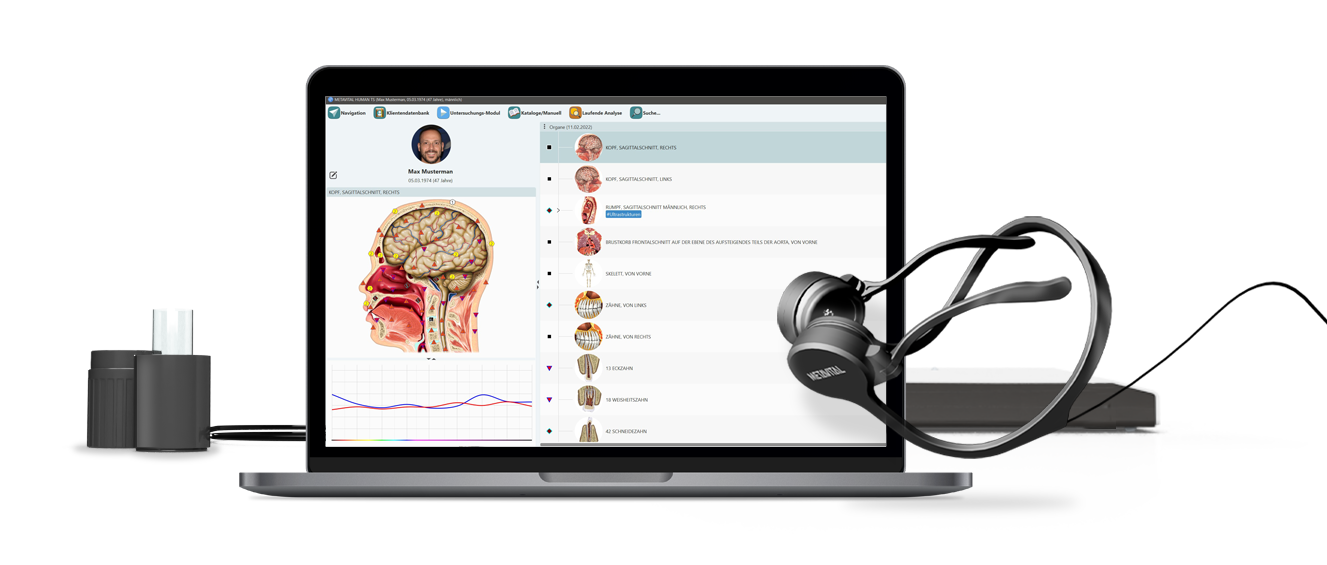 systembild_freigestellt Laptop mit Darstellung eines Auswertungssystems für funktionelle Zellanalyse und Kopfhörer